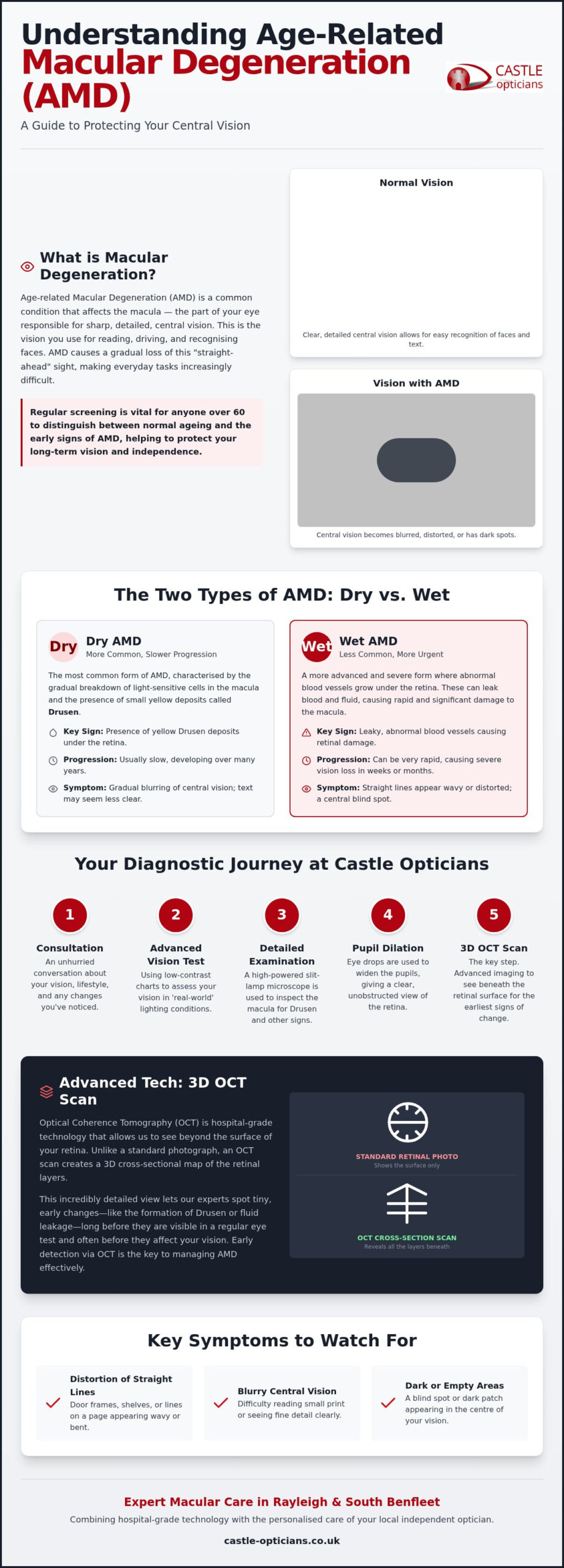 Macular Degeneration Test Essex: Expert Detection at Castle Opticians